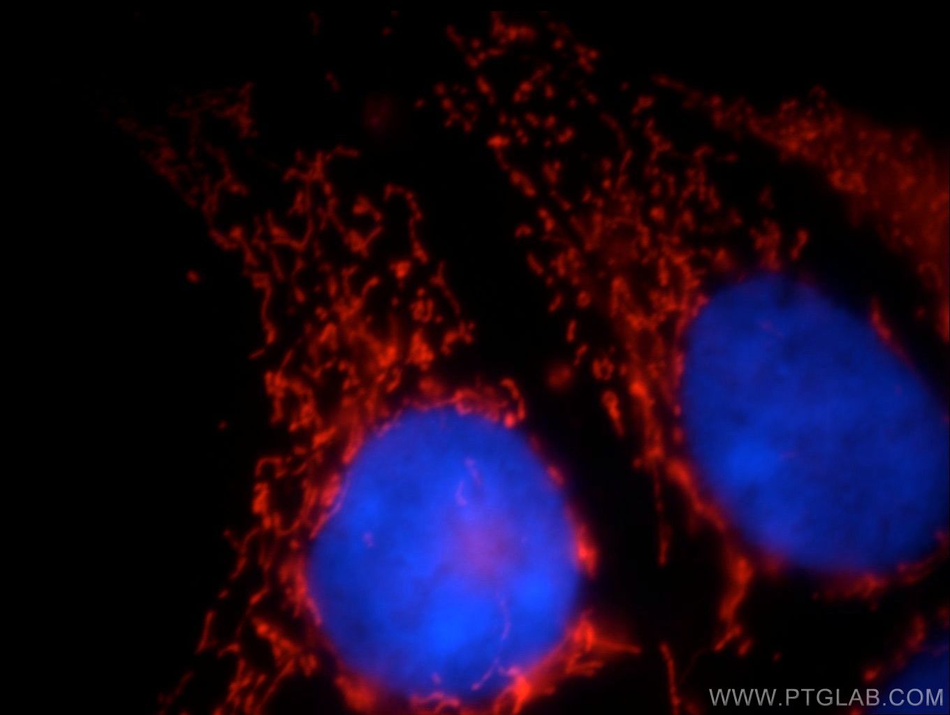 IF Staining of HEK-293 using 21175-1-AP