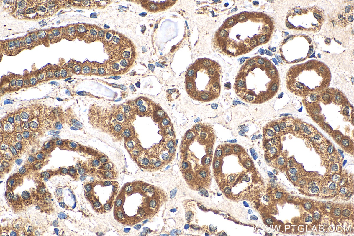 Immunohistochemistry (IHC) staining of human kidney tissue using LRPPRC Polyclonal antibody (21175-1-AP)