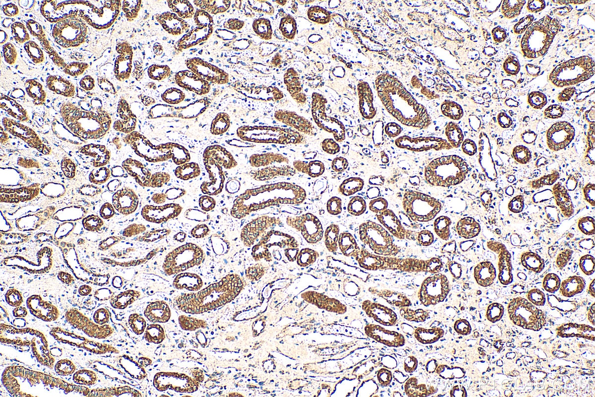 Immunohistochemistry (IHC) staining of human kidney tissue using LRPPRC Polyclonal antibody (21175-1-AP)