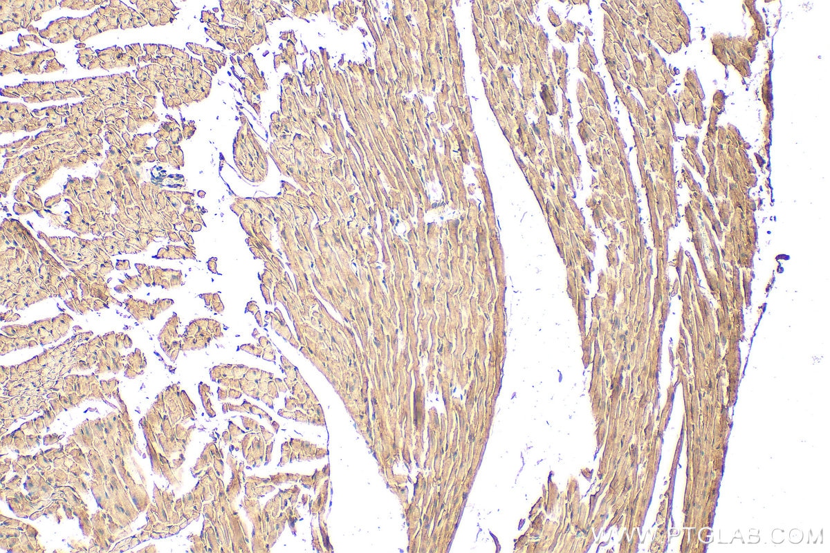 Immunohistochemistry (IHC) staining of mouse heart tissue using LRPPRC Polyclonal antibody (21175-1-AP)