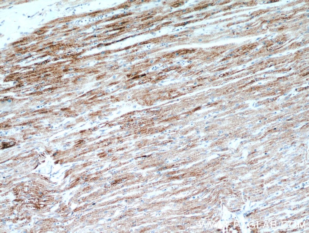 Immunohistochemistry (IHC) staining of human heart tissue using LRPPRC Polyclonal antibody (21175-1-AP)