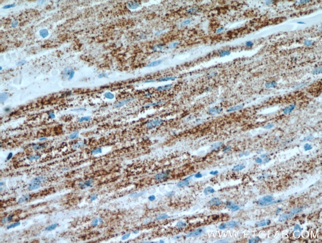 Immunohistochemistry (IHC) staining of human heart tissue using LRPPRC Polyclonal antibody (21175-1-AP)