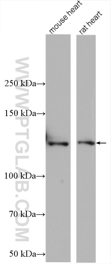 Western Blot (WB) analysis of various lysates using LRPPRC Polyclonal antibody (21175-1-AP)