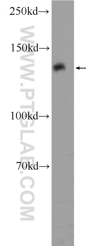 WB analysis of rat kidney using 21175-1-AP