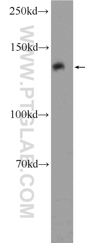 Western Blot (WB) analysis of rat kidney tissue using LRPPRC Polyclonal antibody (21175-1-AP)