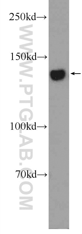 Western Blot (WB) analysis of rat liver tissue using LRPPRC Polyclonal antibody (21175-1-AP)