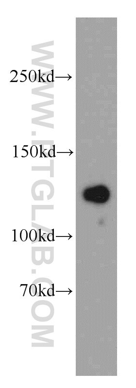 Western Blot (WB) analysis of mouse heart tissue using LRPPRC Polyclonal antibody (21175-1-AP)