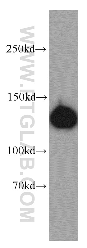 Western Blot (WB) analysis of HepG2 cells using LRPPRC Polyclonal antibody (21175-1-AP)