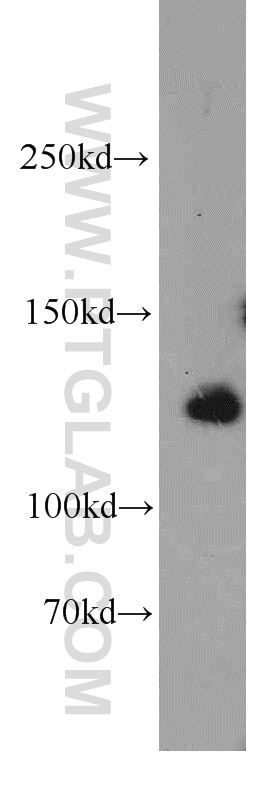 Western Blot (WB) analysis of mouse skeletal muscle tissue using LRPPRC Polyclonal antibody (21175-1-AP)