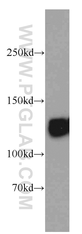 Western Blot (WB) analysis of mouse kidney tissue using LRPPRC Polyclonal antibody (21175-1-AP)