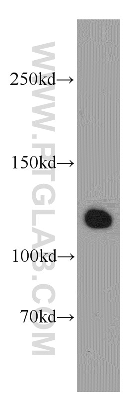 Western Blot (WB) analysis of mouse liver tissue using LRPPRC Polyclonal antibody (21175-1-AP)