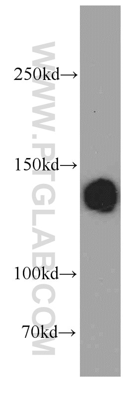 Western Blot (WB) analysis of HeLa cells using LRPPRC Polyclonal antibody (21175-1-AP)