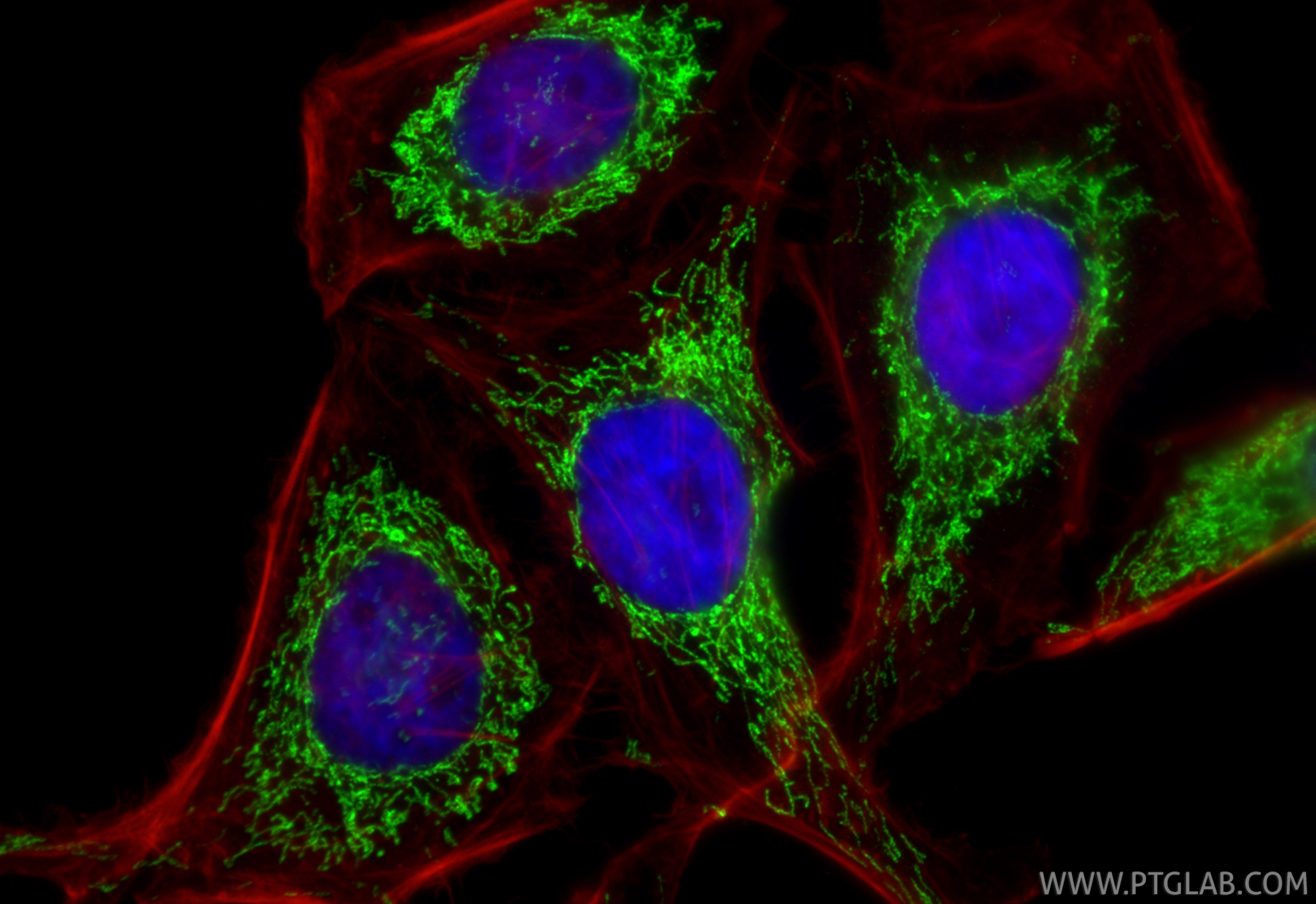 Immunofluorescence (IF) / fluorescent staining of HeLa cells using LRPPRC Monoclonal antibody (67679-1-Ig)