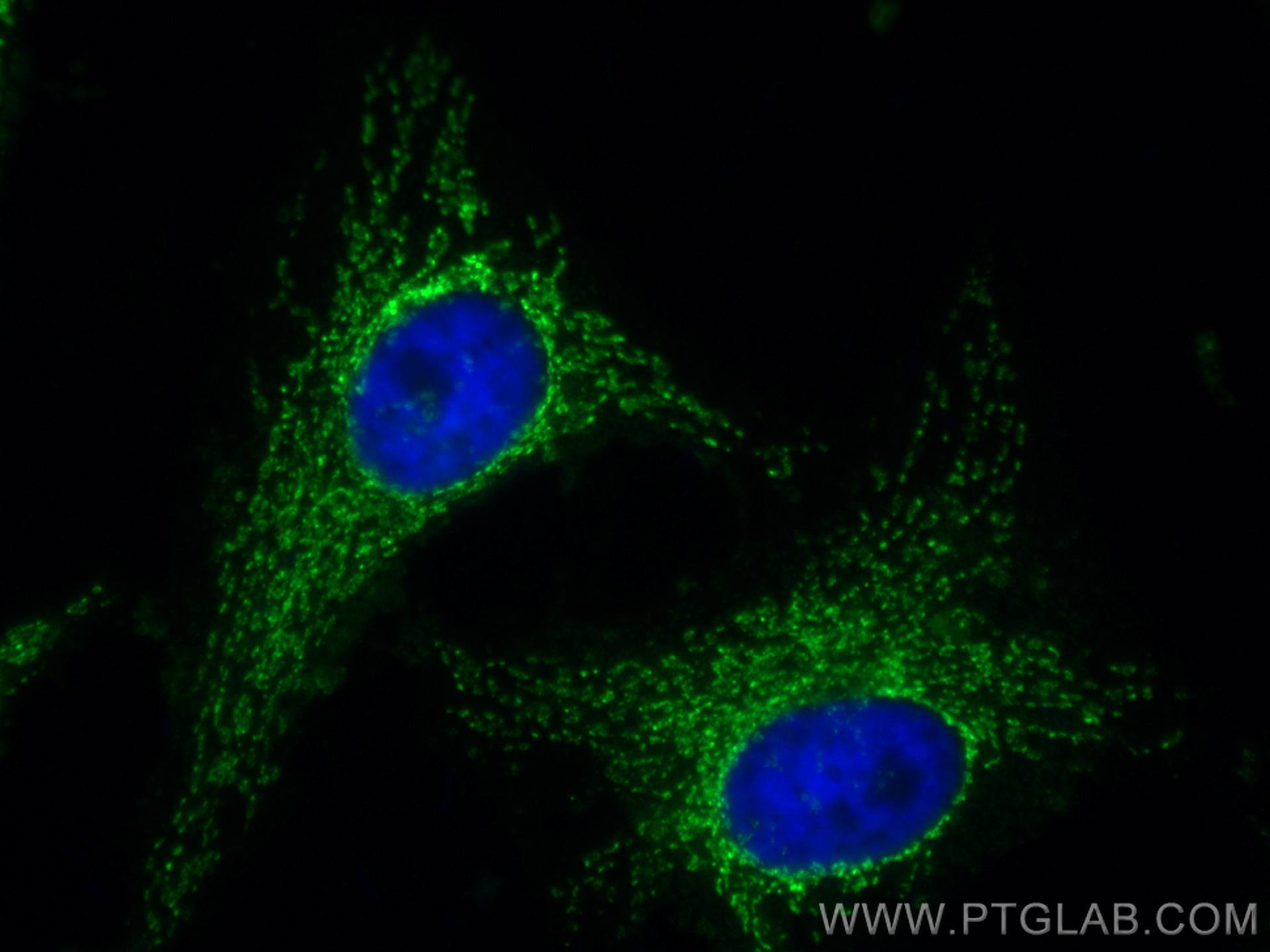 IF Staining of HeLa using CL488-67679