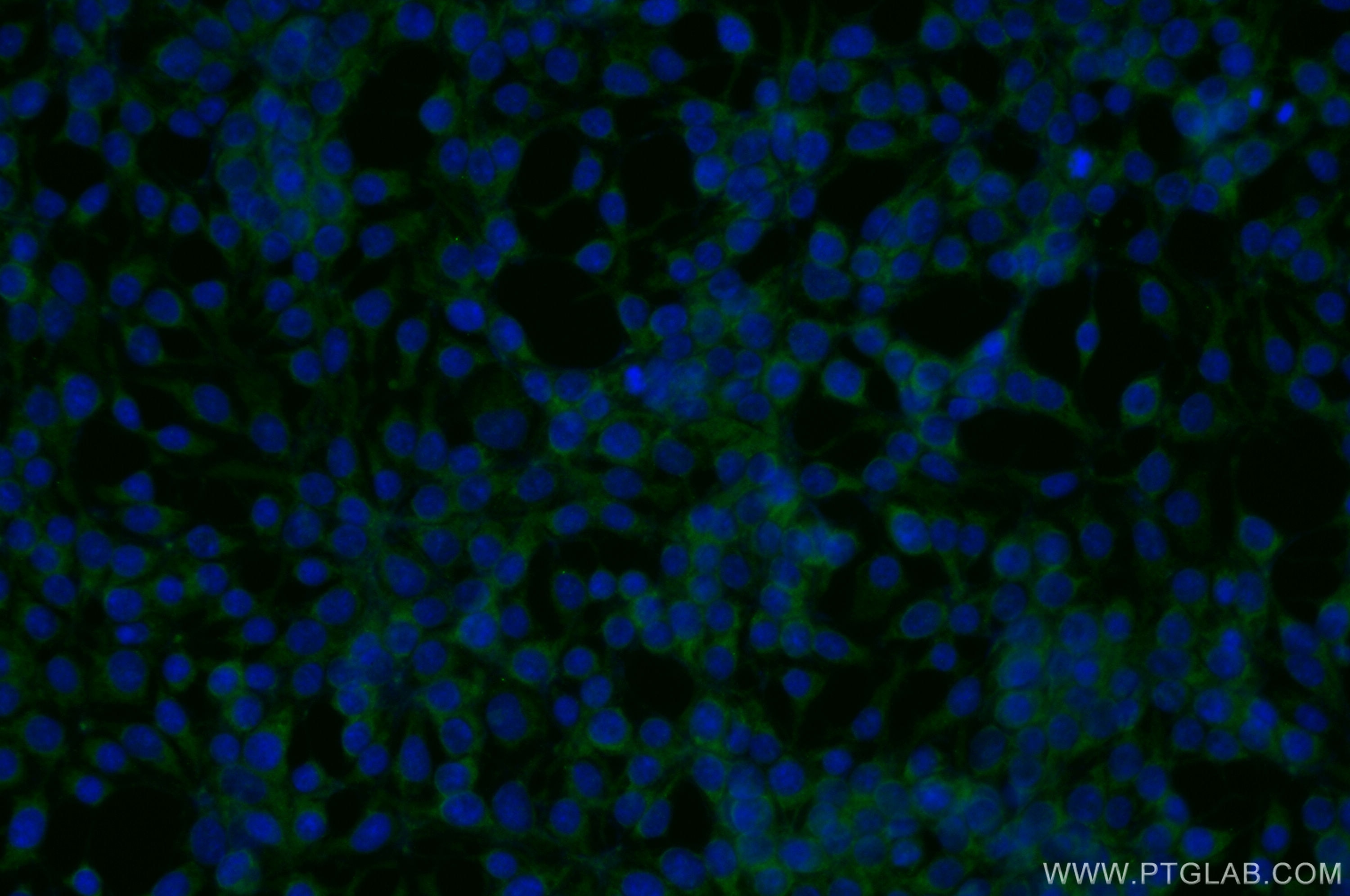Immunofluorescence (IF) / fluorescent staining of HEK-293 cells using LRRC1 Polyclonal antibody (10128-2-AP)
