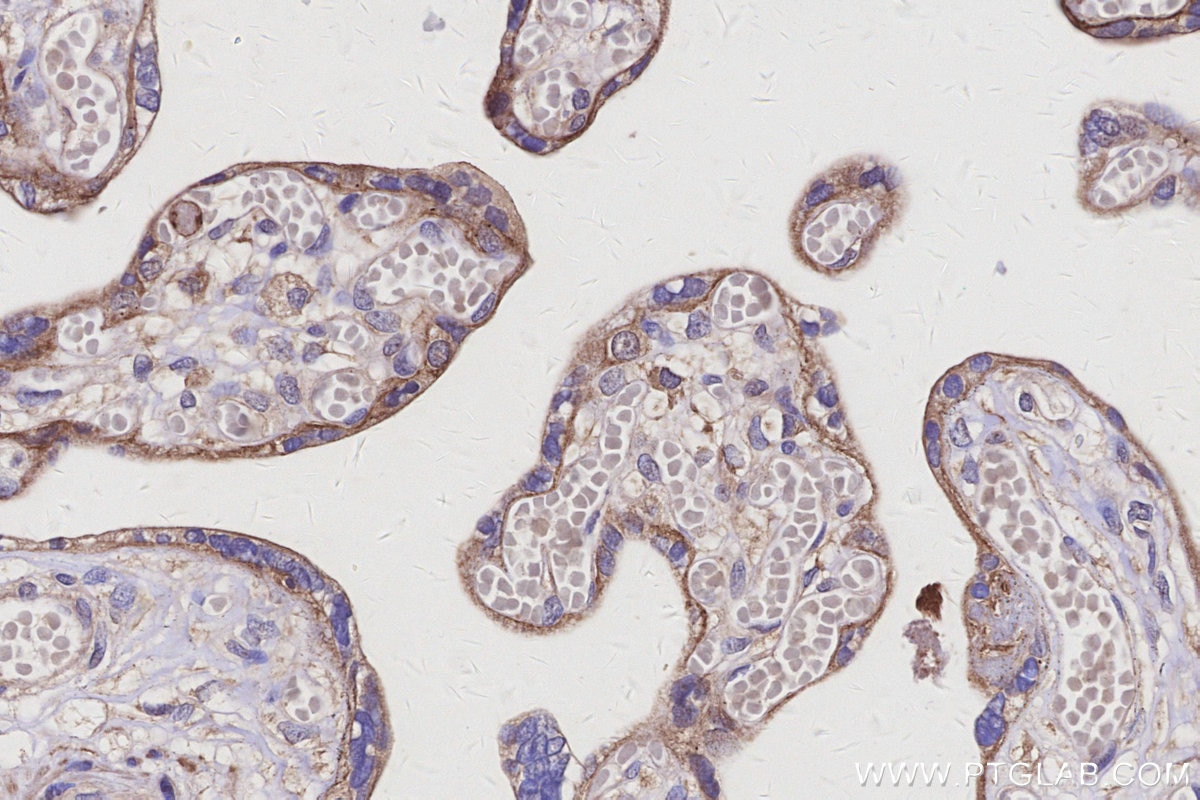 Immunohistochemistry (IHC) staining of human placenta tissue using LRRC1 Polyclonal antibody (10128-2-AP)