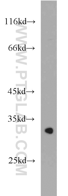Western Blot (WB) analysis of mouse brain tissue using LRRC10 Polyclonal antibody (21575-1-AP)