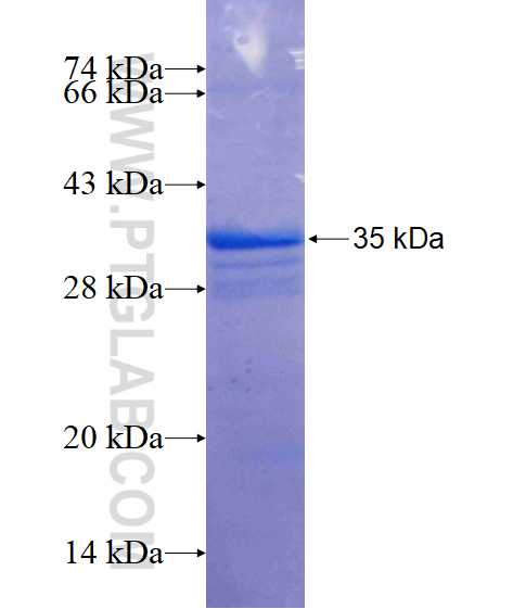 LRRC10 fusion protein Ag17074 SDS-PAGE