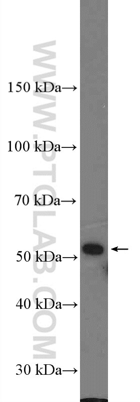 Western Blot (WB) analysis of HeLa cells using LRRC17 Polyclonal antibody (20918-1-AP)