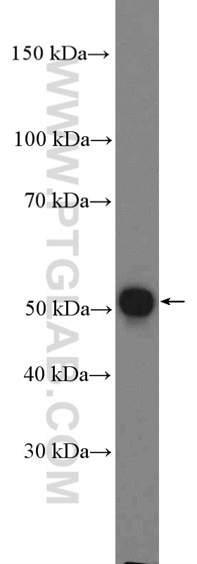 Western Blot (WB) analysis of mouse heart tissue using LRRC17 Polyclonal antibody (20918-1-AP)