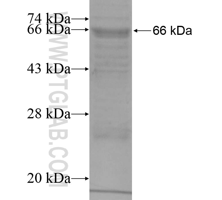 LRRC17 fusion protein Ag15117 SDS-PAGE
