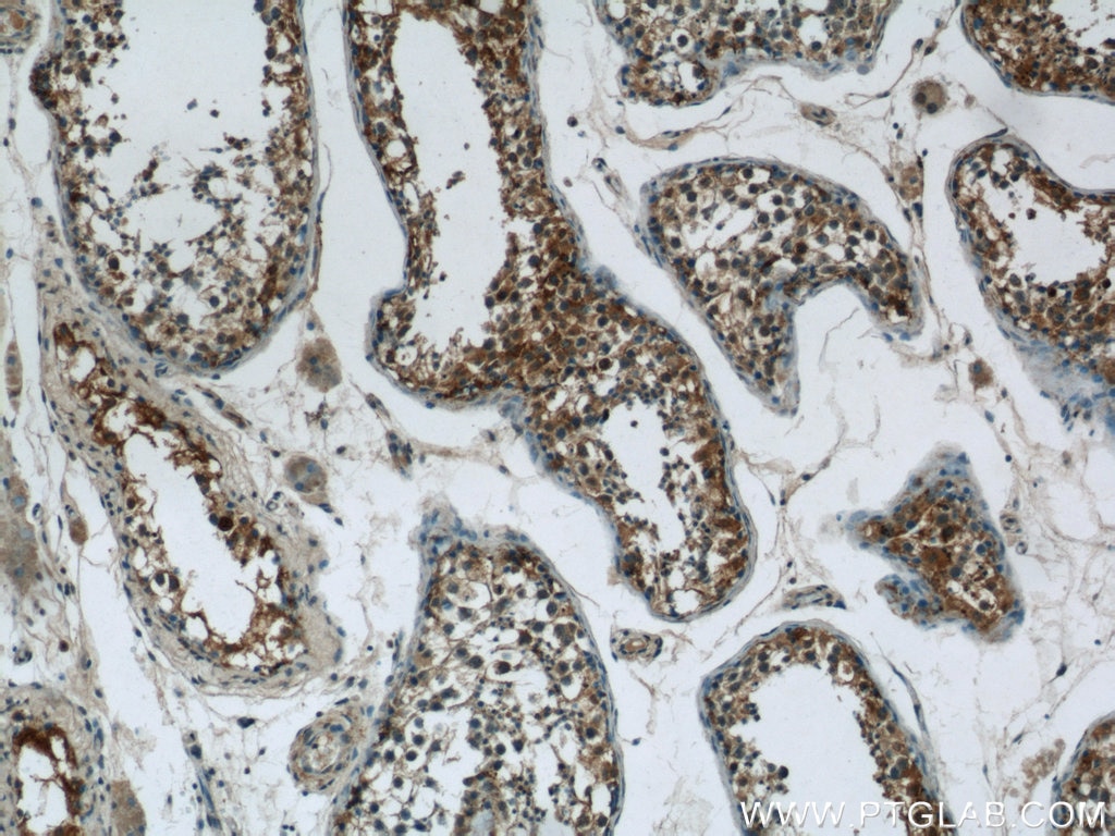 Immunohistochemistry (IHC) staining of human testis tissue using LRRC18 Polyclonal antibody (24571-1-AP)