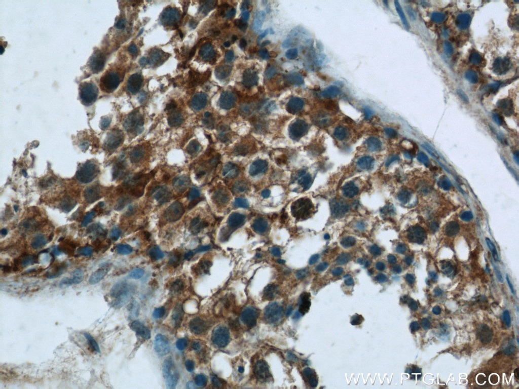 Immunohistochemistry (IHC) staining of human testis tissue using LRRC18 Polyclonal antibody (24571-1-AP)
