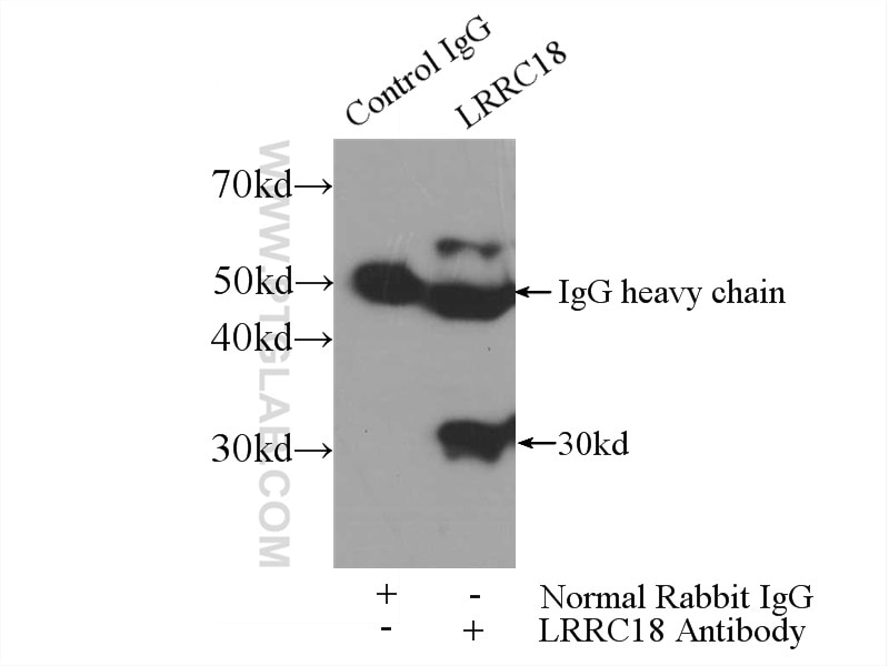 Immunoprecipitation (IP) experiment of mouse testis tissue using LRRC18 Polyclonal antibody (24571-1-AP)