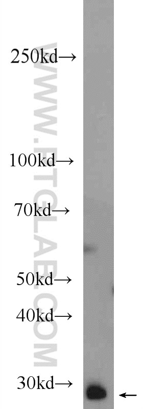 Western Blot (WB) analysis of mouse testis tissue using LRRC18 Polyclonal antibody (24571-1-AP)