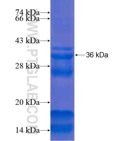 LRRC18 fusion protein Ag20996 SDS-PAGE