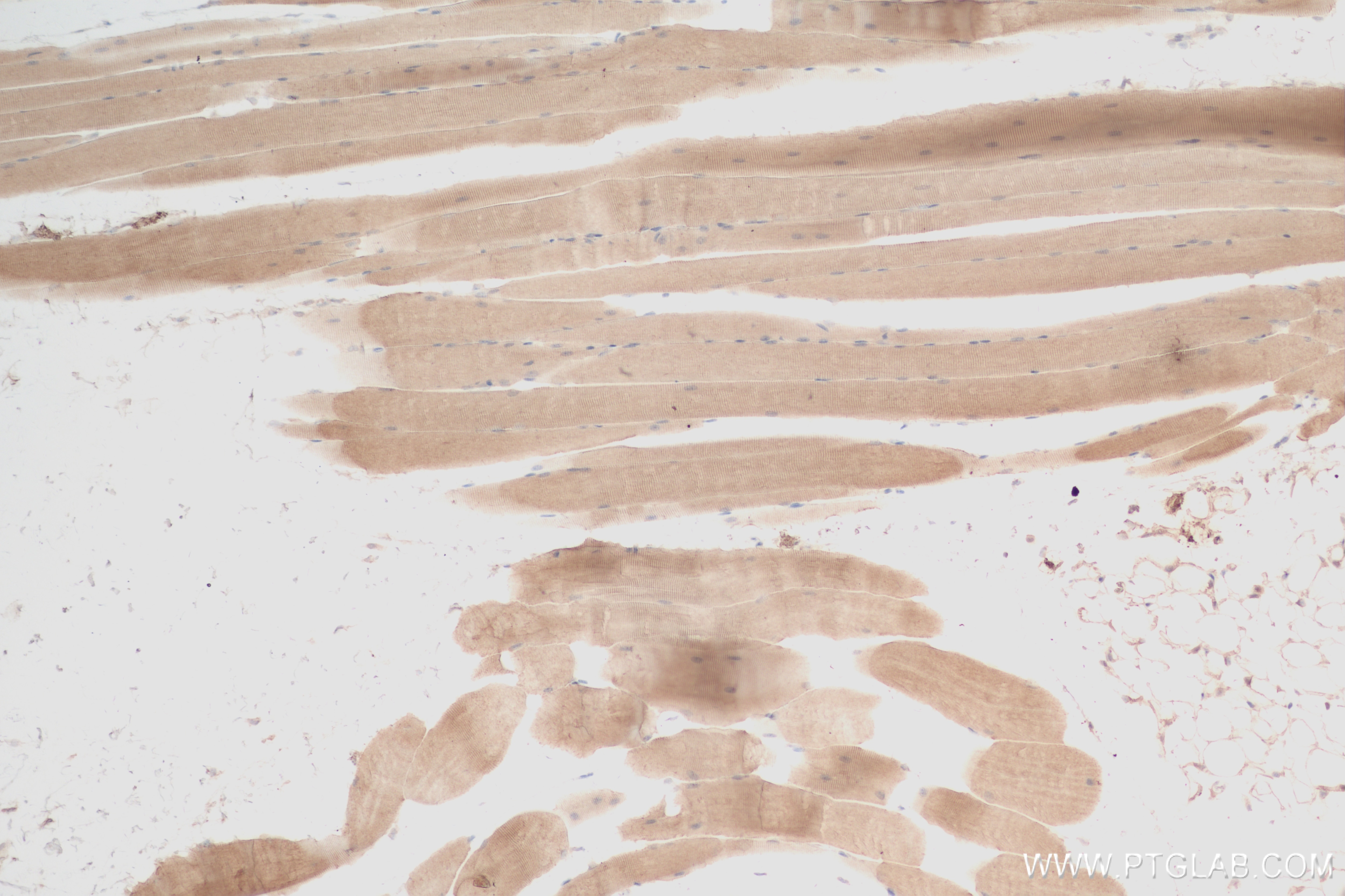 Immunohistochemistry (IHC) staining of mouse skeletal muscle tissue using LRRC2 Recombinant antibody (84404-1-RR)