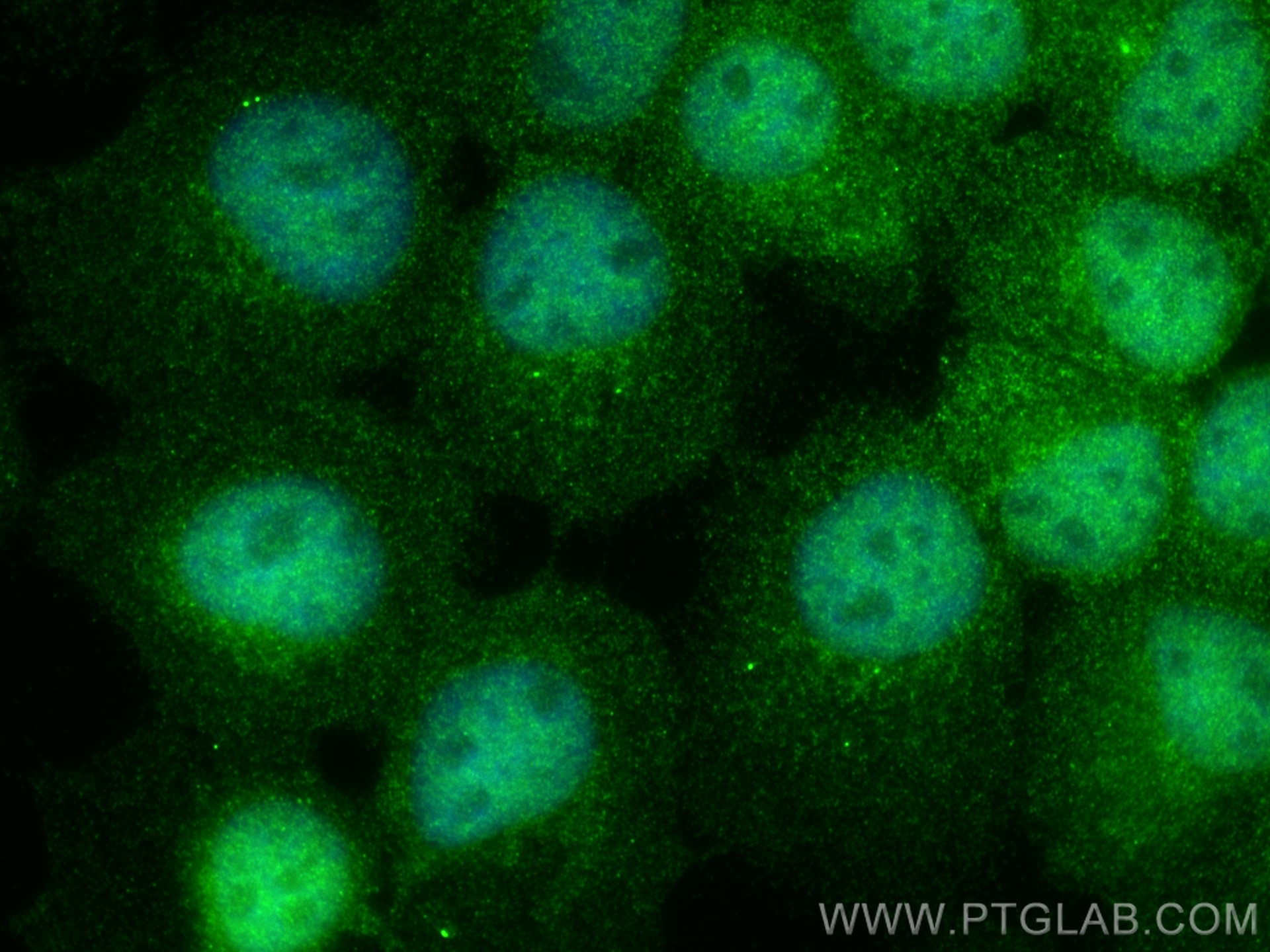 Immunofluorescence (IF) / fluorescent staining of A431 cells using LRRC20 Polyclonal antibody (25562-1-AP)