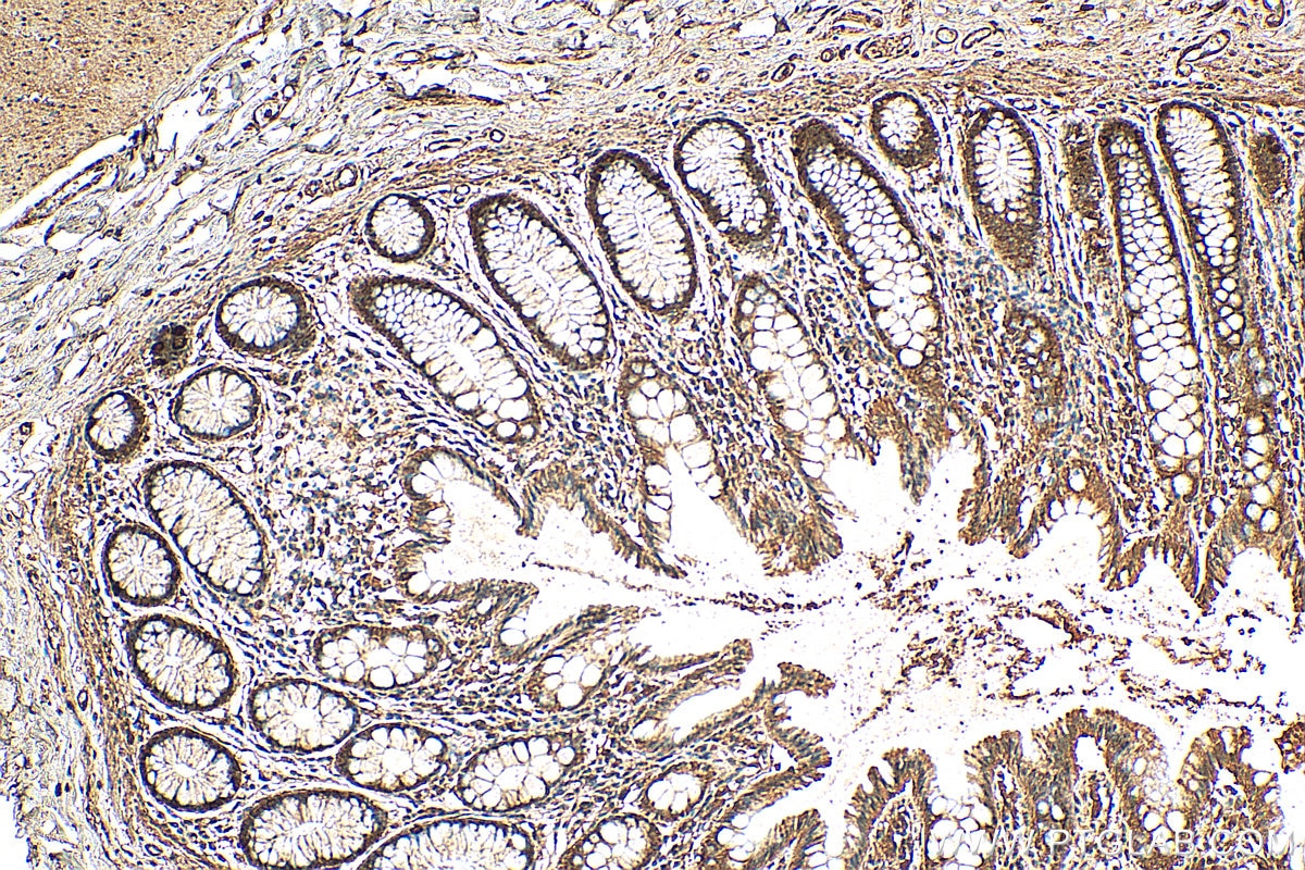 Immunohistochemistry (IHC) staining of human colon tissue using LRRC20 Polyclonal antibody (25562-1-AP)