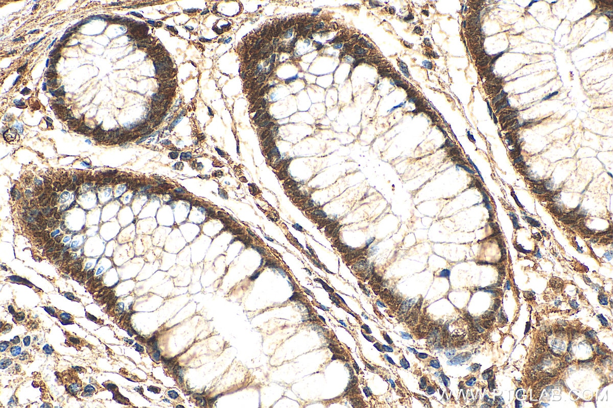 Immunohistochemistry (IHC) staining of human colon tissue using LRRC20 Polyclonal antibody (25562-1-AP)