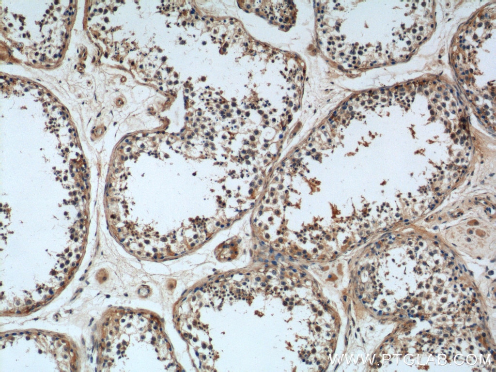 Immunohistochemistry (IHC) staining of human testis tissue using LRRC20 Polyclonal antibody (25562-1-AP)