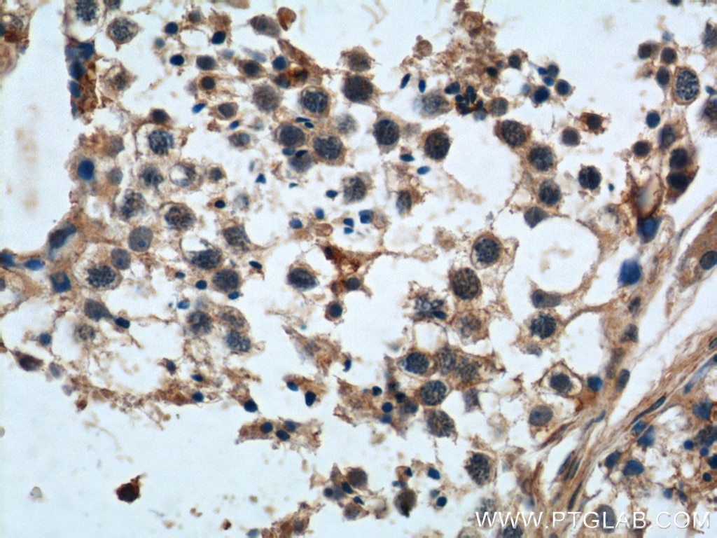 IHC staining of human testis using 25562-1-AP