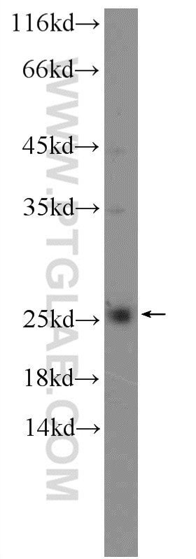 Western Blot (WB) analysis of NIH/3T3 cells using LRRC20 Polyclonal antibody (25562-1-AP)