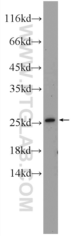 Western Blot (WB) analysis of Y79 cells using LRRC20 Polyclonal antibody (25562-1-AP)
