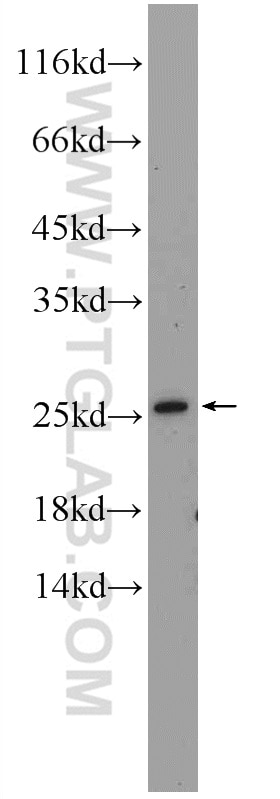 Western Blot (WB) analysis of Y79 cells using LRRC20 Polyclonal antibody (25562-1-AP)