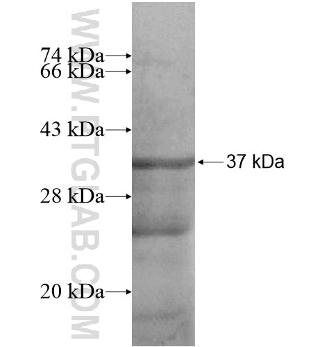 LRRC25 fusion protein Ag15076 SDS-PAGE