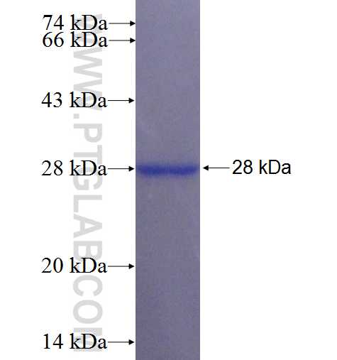 LRRC29 fusion protein Ag22577 SDS-PAGE