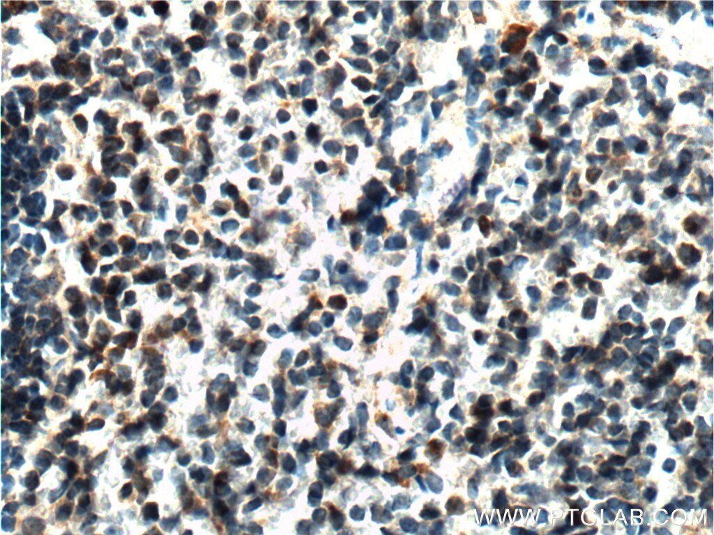 Immunohistochemistry (IHC) staining of mouse spleen tissue using LRRC32 Polyclonal antibody (26021-1-AP)