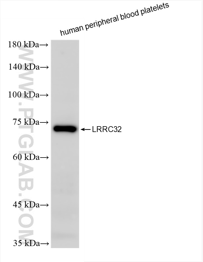 human peripheral blood platelets were subjected to SDS PAGE followed by western blot with 86059-2-RR (LRRC32 antibody) at dilution of 1:1000 incubated at room temperature for 1.5 hours. Western Blot (WB) analysis of human peripheral blood platelets using LRRC32 Recombinant antibody (86059-2-RR)