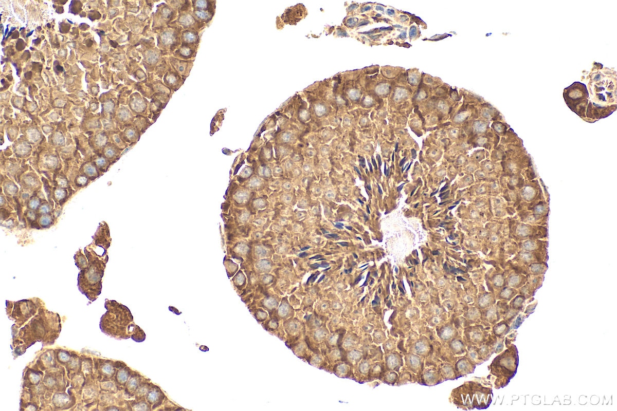 IHC staining of mouse testis using 32450-1-AP Immunohistochemistry (IHC) staining of mouse testis tissue using LRRC37A2 Polyclonal antibody (32450-1-AP)