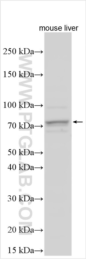 Western Blot (WB) analysis of various lysates using LRRC4 Polyclonal antibody (24834-1-AP)