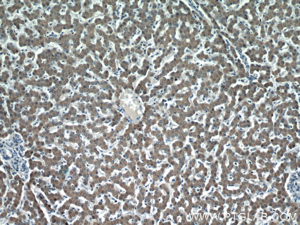 Immunohistochemistry (IHC) staining of human liver tissue using LRRC41 Polyclonal antibody (20457-1-AP)