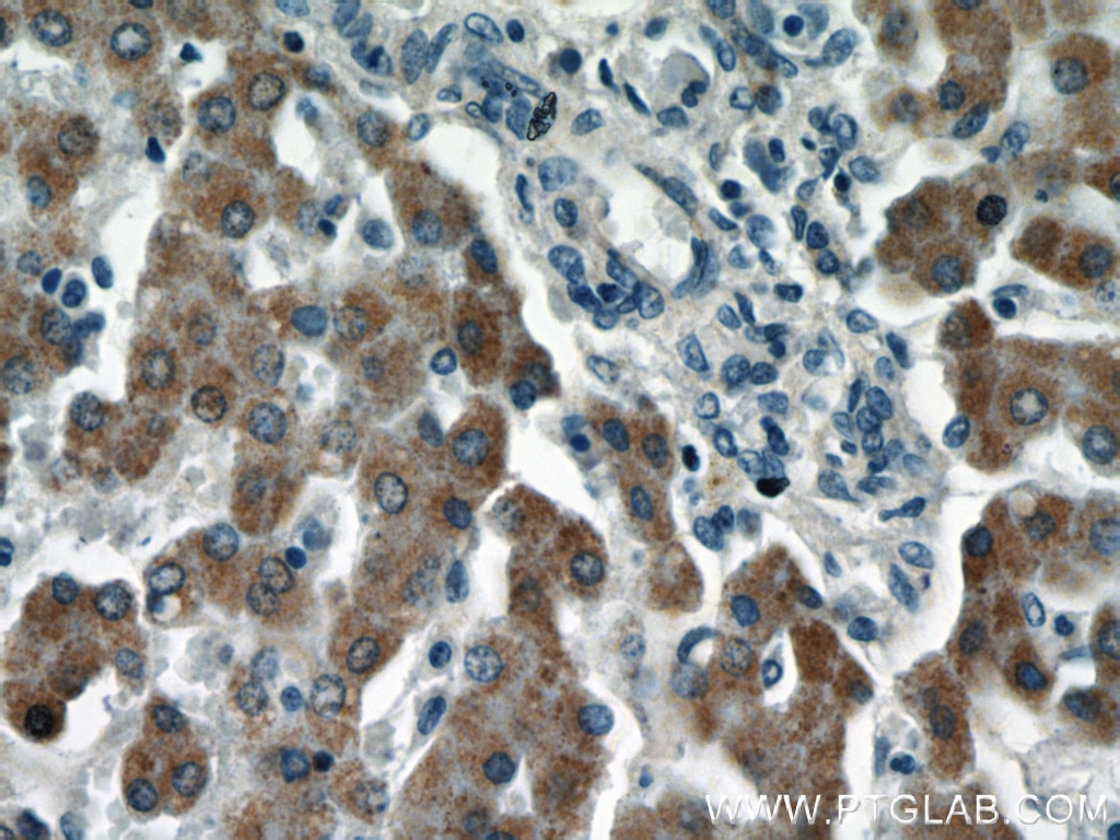 Immunohistochemistry (IHC) staining of human liver tissue using LRRC41 Polyclonal antibody (20457-1-AP)