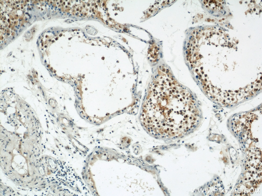 IHC staining of human testis using 20457-1-AP