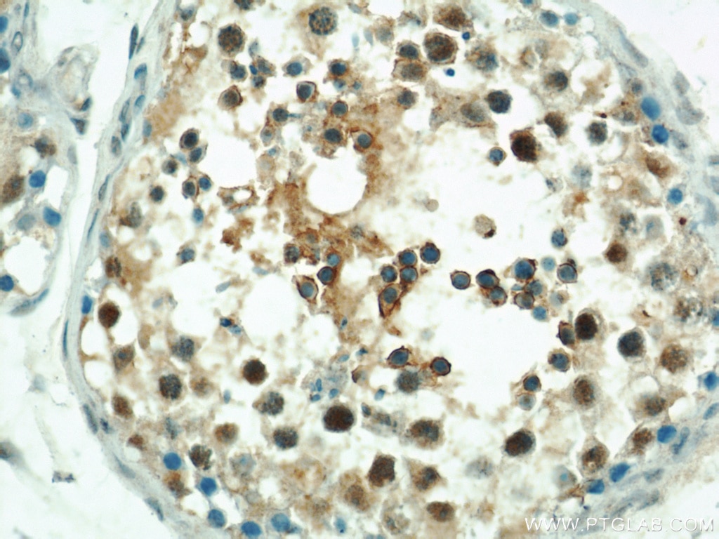Immunohistochemistry (IHC) staining of human testis tissue using LRRC41 Polyclonal antibody (20457-1-AP)