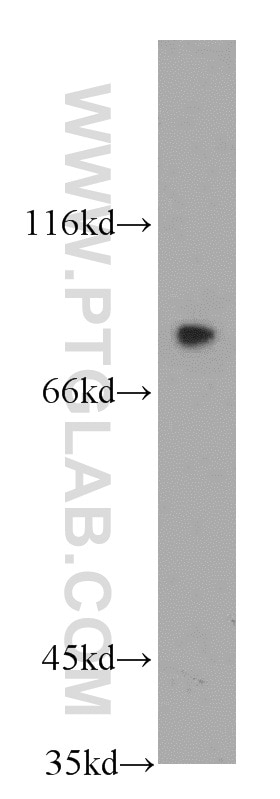 Western Blot (WB) analysis of human brain tissue using LRRC41 Polyclonal antibody (20457-1-AP)